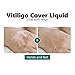 20ml Vitiligo Covering Liquid, White spot concealer, Waterproof Makeup Vitiligo Concealer Cosmetics for Face Body, skin tone concealer