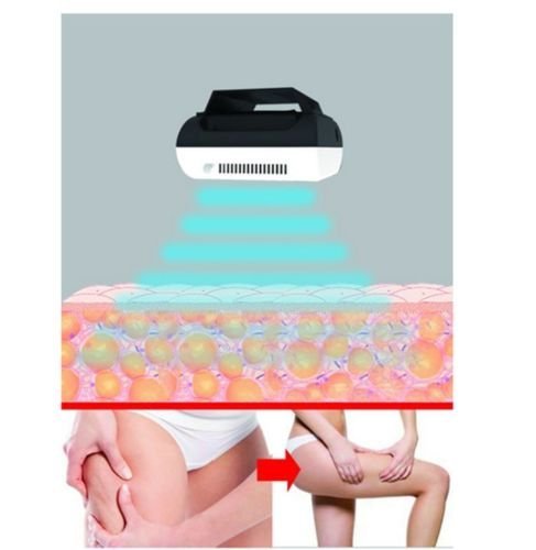 The Ultimate Shape-N-Freeze Body Sculpting Fat Freezer System