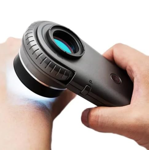 Dermatoscope ILLUCO IDS-1100, 10x Magnification, Handheld + CHARGIND STATION + MOBILE ADAPTOR