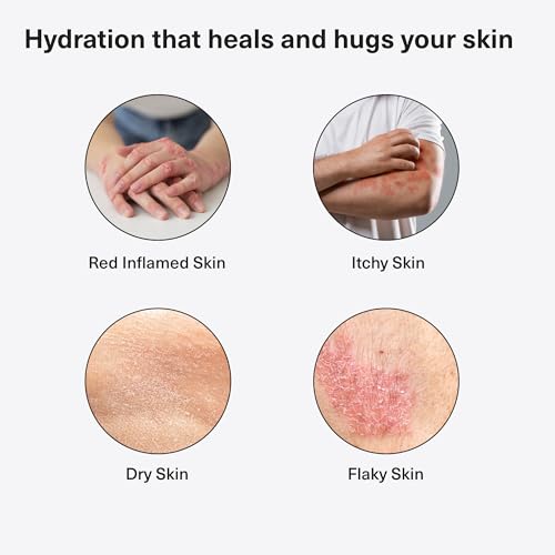 Healpsorin Antifungal Body Wash: Psoriasis, Eczema, Dermatitis and Sensitive Shower Gel - Eczema Treatment - 500ml - Image 4