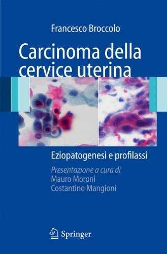 Carcinoma della cervice uterina: Eziopatogenesi e
