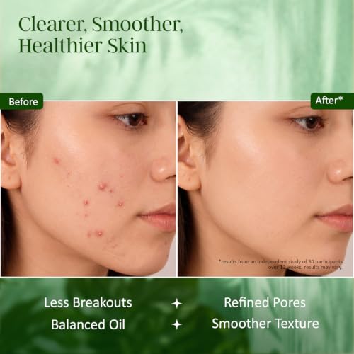 Image of Scrub Soap with Salicylic Acid & Neem - Exfoliating Body & Face Soap - Enriched with Niacinamide, Tea Tree Extract, Neem, Salicylic Acid - 110g /3.88Oz
