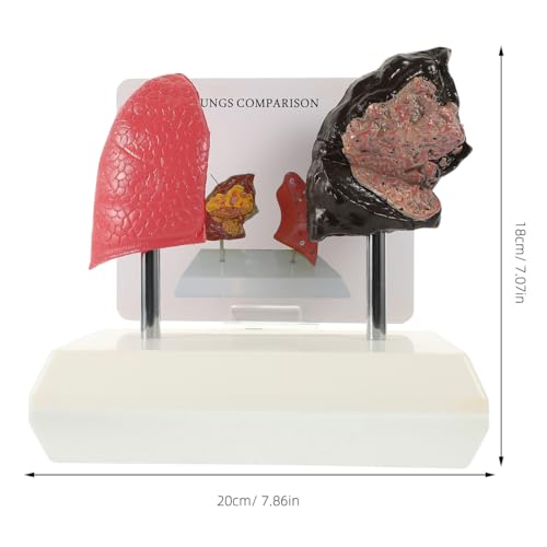Cabilock Smoking Lung and Normal Lung Comparison Model 7.87X7.08X5.51 Inch Pulmonary Anatomy Medical Teaching Model for Respiratory Health Education