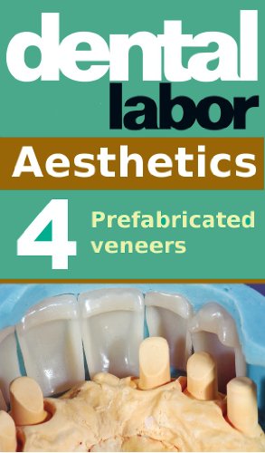 Prefabricated veneers (dental lab technology articles Book 13)