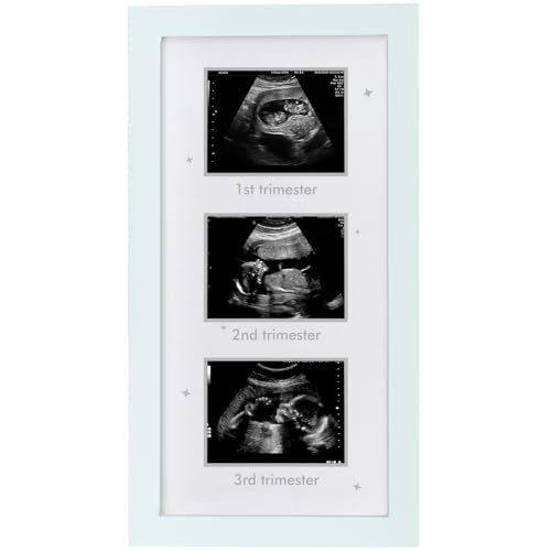 Image of HAMUIERS Ultrasound Picture Frame - Triple Sonogram Frame for Mom to Be | Pregnancy Photo Album Decor | Baby Nursery Essentials & Gender Reveal Gifts | First Trimester Keepsake & Pregnancy Must Haves - White2