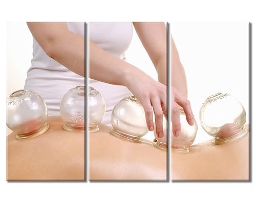 Image of Cupping Massage Wall Art Traditional Chinese Cupping Therapy Posters Wall Art for Living Nosocomium 3 Panels Art Prints Giclee Wooden Framed Gallery-Wrapped Ready to Hang (60 inch Wx40 H)