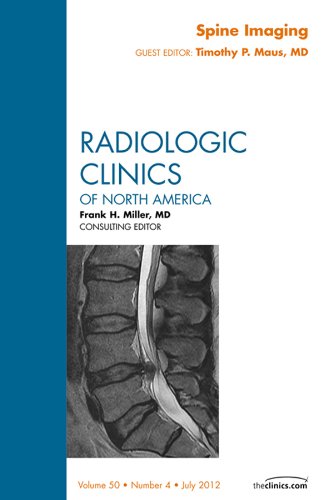 Spine Imaging, An Issue of Radiologic Clinics of North America (The Clinics: Radiology Book 50) (Volume 50-4)      1st Edition, Kindle Edition