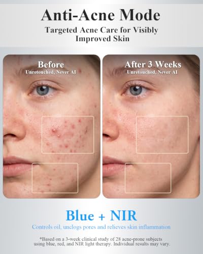 Image of Red Light Therapy for Face, Clinically Tested&FDA-Cleared, All-New2026Model