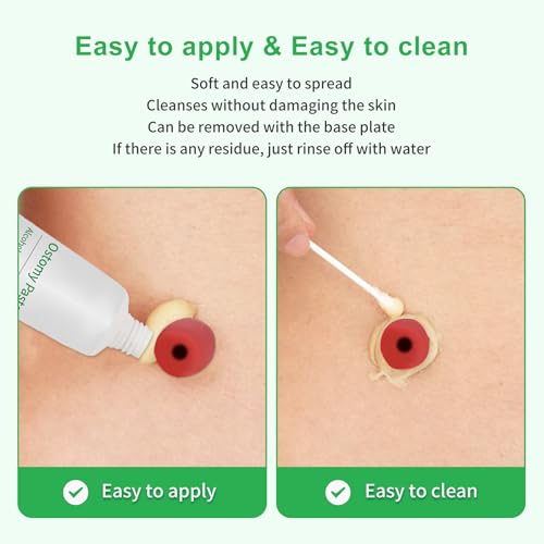 stoma skin barrer pasteostomy paste 2 oz tube 1 pack