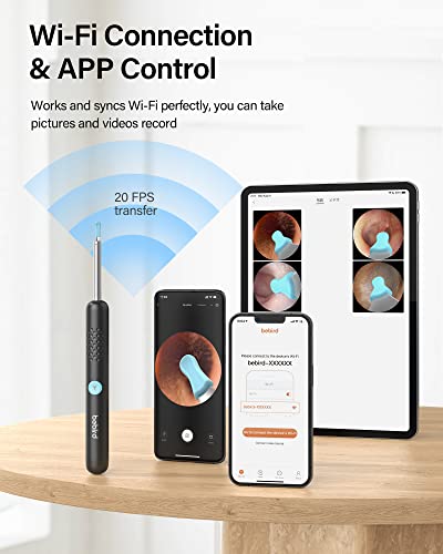 Ear Wax Removal,Bebird Ear Cleaner With Camera,Ear Wax Removal Tool Camera With 1080P Otoscope 6 Led Light, Ear Wax Removal Kit With 6 Ear Pick,3 Pcs Set,Ear Cleaning Kit For Ios & Android #TOP6