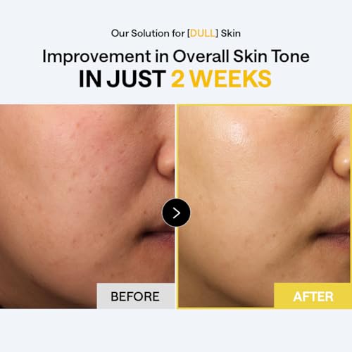 Image of MEDIHEAL Toner Pads 100 Count - Vitamin C Skin Toning - Radiance Booster for Clear & Illuminating Skin - Contains Niacinamide for Blemish Care - Vegan Stretchable Fabric Pads, Korean Skin Care