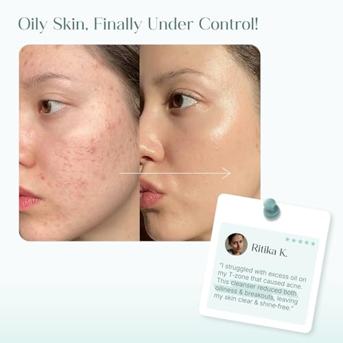 Image of Seoulskin 2% Salicylic Acid Acne Control Face Wash for Oily & Acne Prone Skin | With AHAs for Pore Cleansing, Oil Control & Sebum Regulation | Treats Active Acne | For Women & Men | 100 ml