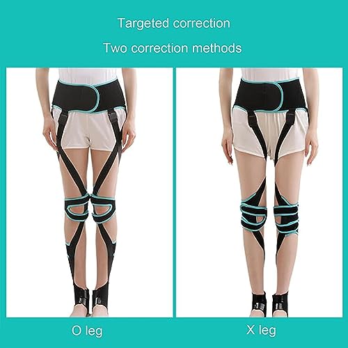 Image of O X Leg Type Correction Belt, Leg Correction Device Posture Corrector Legs, Knock Knees Valgus Deformity Bow Legs Band Straighten Belt for Adult & Kids,M