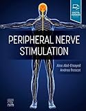 Peripheral Nerve Stimulation: A Comprehensive Guide