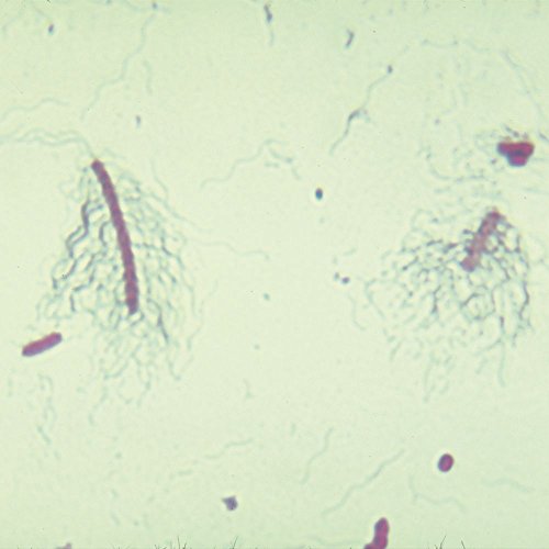 Bacterial Flagella Slide, Peritrichous, W.M.