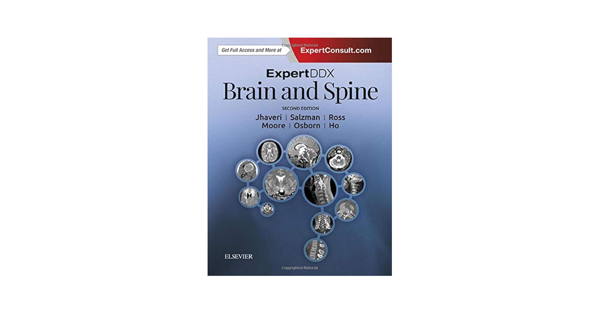 ExpertDDx: Brain and Spine: 9780323443081: Medicine & Health