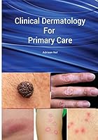 Clinical Dermatology For Primary Care 151759037X Book Cover