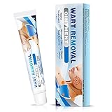 Skin Tag Remover, Wart Remover, Fast-Acting & Effective Skin Tag Removal, Natural Formula Safe and Painless, Remove Skin Tags, Moles and Warts, Wart Removal Treatment for All Skin Type