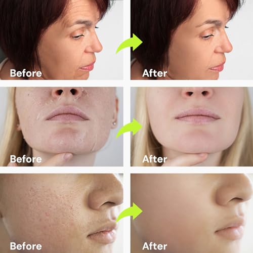 Enaskin Naturals Retinol Serum For Face Anti-Wrinkle: Enaskin Naturals Moisturizing thumb #4