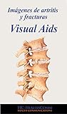  Imágenes de artritis y fracturas, Visual Aids: Full Ilustrado