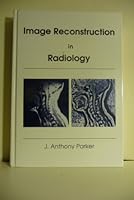 Image Reconstruction in Radiology 0849301505 Book Cover