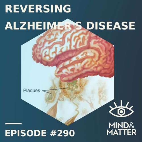 Reversing Alzheimer's & Neurodegeneration: Latest Science | Andrew Pieper | Episode 290