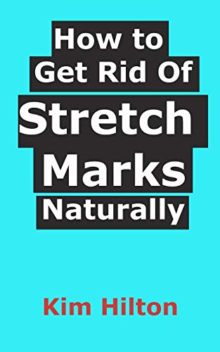Preisvergleich Produktbild How to Get Rid Of Stretch Marks Naturally