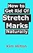 Produktbild How to Get Rid Of Stretch Marks Naturally