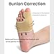 2PCS Hallux Valgus Korrektur, Zehenspreizer Hallux Valgus Bandage, Hallux Valgus Schiene Bunion Corrector,Relieve Fuß Gelenke/Bunion Schmerzen für Männer und Frauen