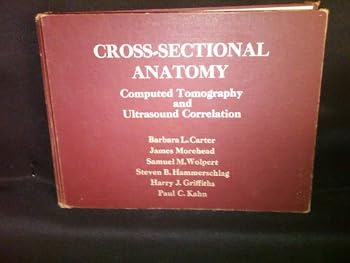 Cross-sectional Anatomy: Computed Tomography and Ultrasound Correlation