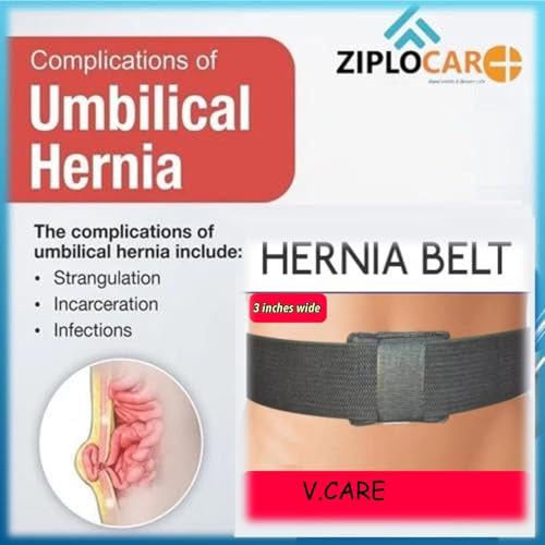 Faja para Hernia Umbilical Talla S Negra miniatura 3
