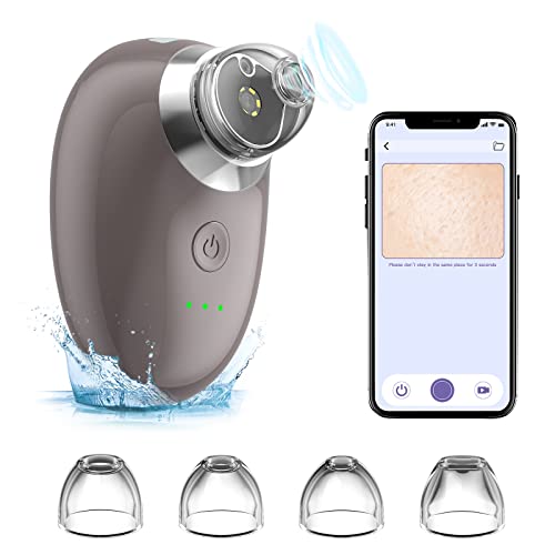 Blackhead Remover Pore Vacuum with Camera,WiFi Mini Visible Pimple Sucker Facial Cleaner Black Head Removal Tools,Pimple Acne Comedone Extractor with 4 Suction Heads