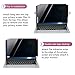 Laptop Privacy Screen 16 Inch for 16:10 Widescreen Display, Anti Blue Light Glare Privacy Filter, For LG Gram 16