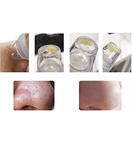 Aparelho Removedor De Cravos Acne 4 Em 1 Espinhas Extrator Sucção Vácuo Sugador Elétrico Portátil Cuidados Com A Pele Rosto 6 Aparelho Removedor De Cravos Acne 4 Em 1 Espinhas Extrator Sucção Vácuo Sugador Elétrico Portátil Cuidados Com A Pele Rosto - Imagem 6