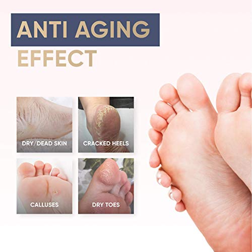 Peel Mask For Dry Hard Feet - Dead Skin & Callus Remover - Foot Spa Experience At Home For Baby Soft Feet - Large Size Exfoliating Socks For Woman And Man - Foot Care Treatment For Healthy Feet 2 Pack #TOP3