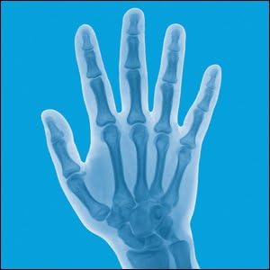 Miniatura 4 de Lindberg Suplemento de apoyo articular para hombres y mujeres  210 cápsulas  con cúrcuma, MSM, glucosamina, condroitina, extracto de boswellia