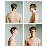 Accutane [Explicit]