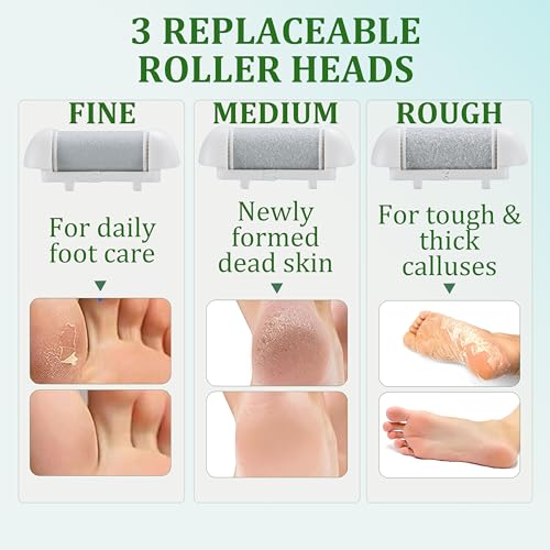 BarberBoss Electric Foot File - Premium Hard Skin Remover - Image 5