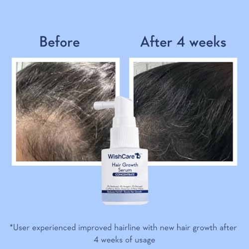 Image of WishCare Hair Growth Serum Concentrate - Resdensyl, Anagain, Caffeine, Biotin, Keratin & Rice Water 20ml