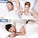 ishancare Nasal Strips for Breathing, 30 Count Sleep Nasal Strips for Snoring, Extra Strength Tan Nose Breathing Strips for Better Sleep, Instant Anti Snoring Nose Tape & Nasal Congestion