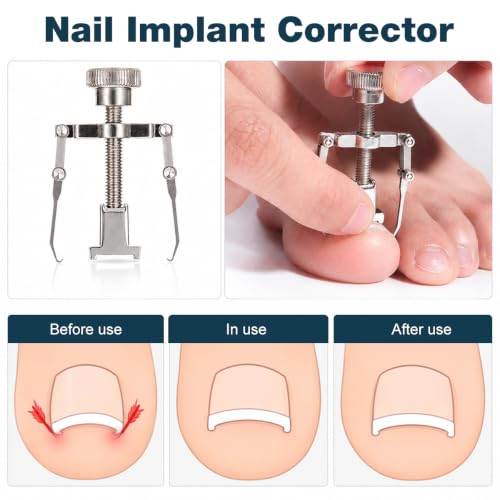 Image of MAYCREATE 10 Pcs Nail Clipper Set for Ingrown Toe Care with Pedicure File