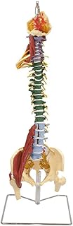 Anatomical Model Torso, Human Spine Model, Muscle Spine with Disorders with Stand, Vertebral Column Model with Spinal Nerves, Skull Base, and Pelvis