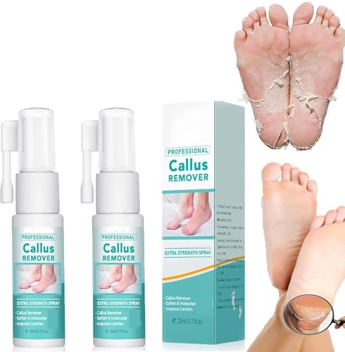 Spray profesional para eliminar callos extrafuerte, espray para eliminar callos de pies, espray removedor de callos de pie y talón, aceite en aerosol para eliminar la piel muerta y los callos en los