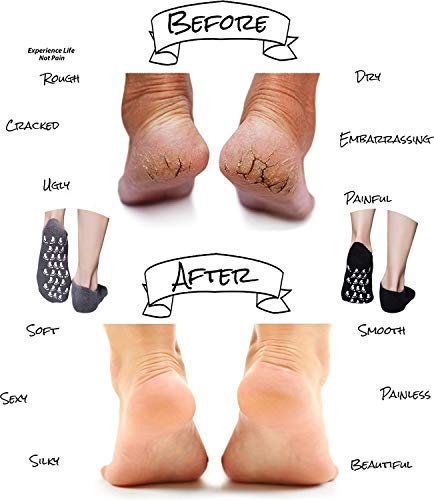 Gel Socks, Moisturizing Socks, Soft Moisturizing Gel Socks, Gel Spa Socks For Repairing And Softening Dry Cracked Feet Skins, Gel Lining Infused With Essential Oils And Vitamins (Black&Gray) #TOP2