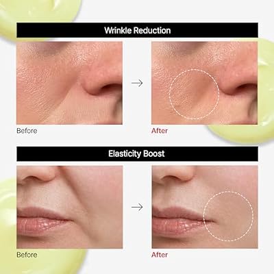Dr.Different VITALIFT-A Retinal, Intensive Anti-Aging Cream for Wrinkle Reduction, Skin Elasticity, Lifting, Firming with Vita A, K-Skincare made by Korean Dermatologist.