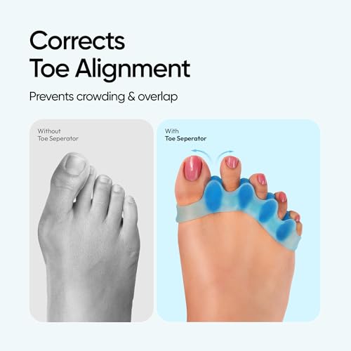 Image of Frido Orthotics Toe Separator | Ergonomic Gel Toe Straightener for Bunion Relief | Toe Corrector for Women & Men | Foot Alignment Spacer for Overlapping Toes & Foot Pain (Blue, Size - S), Pair of 1