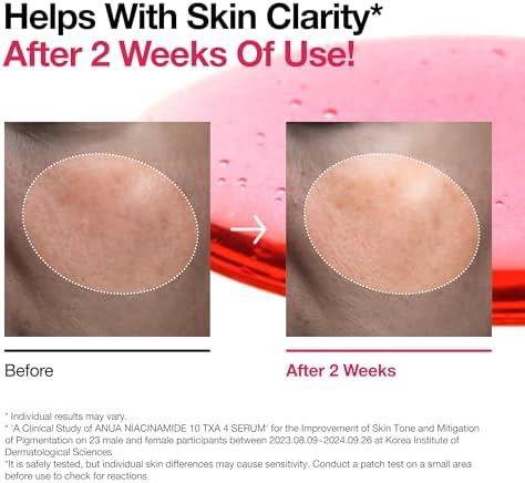 Niacinamide 10 + TXA 4 Serum, Hyaluronic Acid,