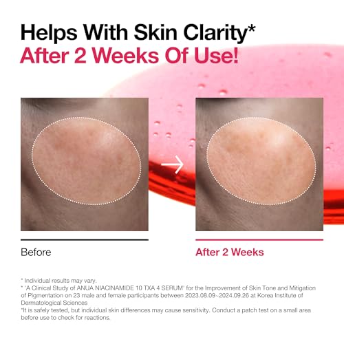 ANUA Suero con 10% de niacinamida y 4% de ácido tranexámico, ceramida, ácido hialurónico, vitamina B12, color natural, para pieles sensibles, piel de cristal coreana, sin fragancia 30 ml/1,01 fl.oz. - imagen 4