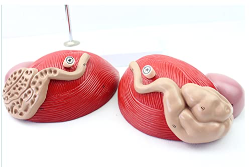 Modèle de prostate résolvant les difficultés d'apprentissage - 8
