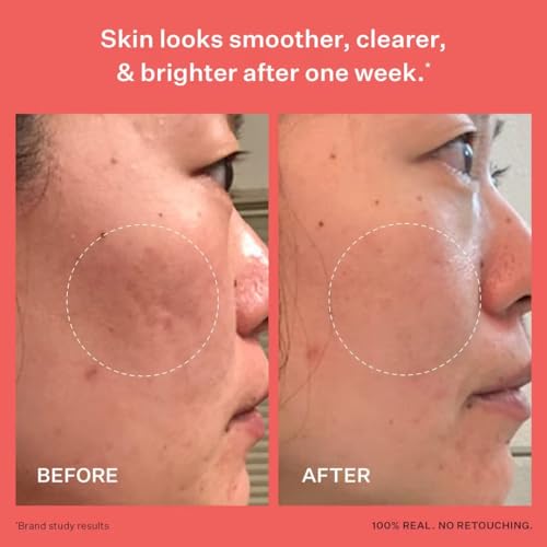 Peach & Lily - Glass Skin Refining Serum for Face (1.35 ounces) - Hyaluronic Acid Niacinamide Serum - Sensitive Skin - Vitamin B3, Peach & Yam, Peptides - Self Care, Vegan, Cruelty Free, Korean Beauty - Image 5